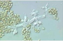 /jishuzhishi/85.html